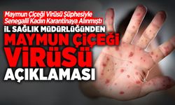 İl Sağlık Müdürlüğünden Maymun Çiçeği Virüsü Açıklaması